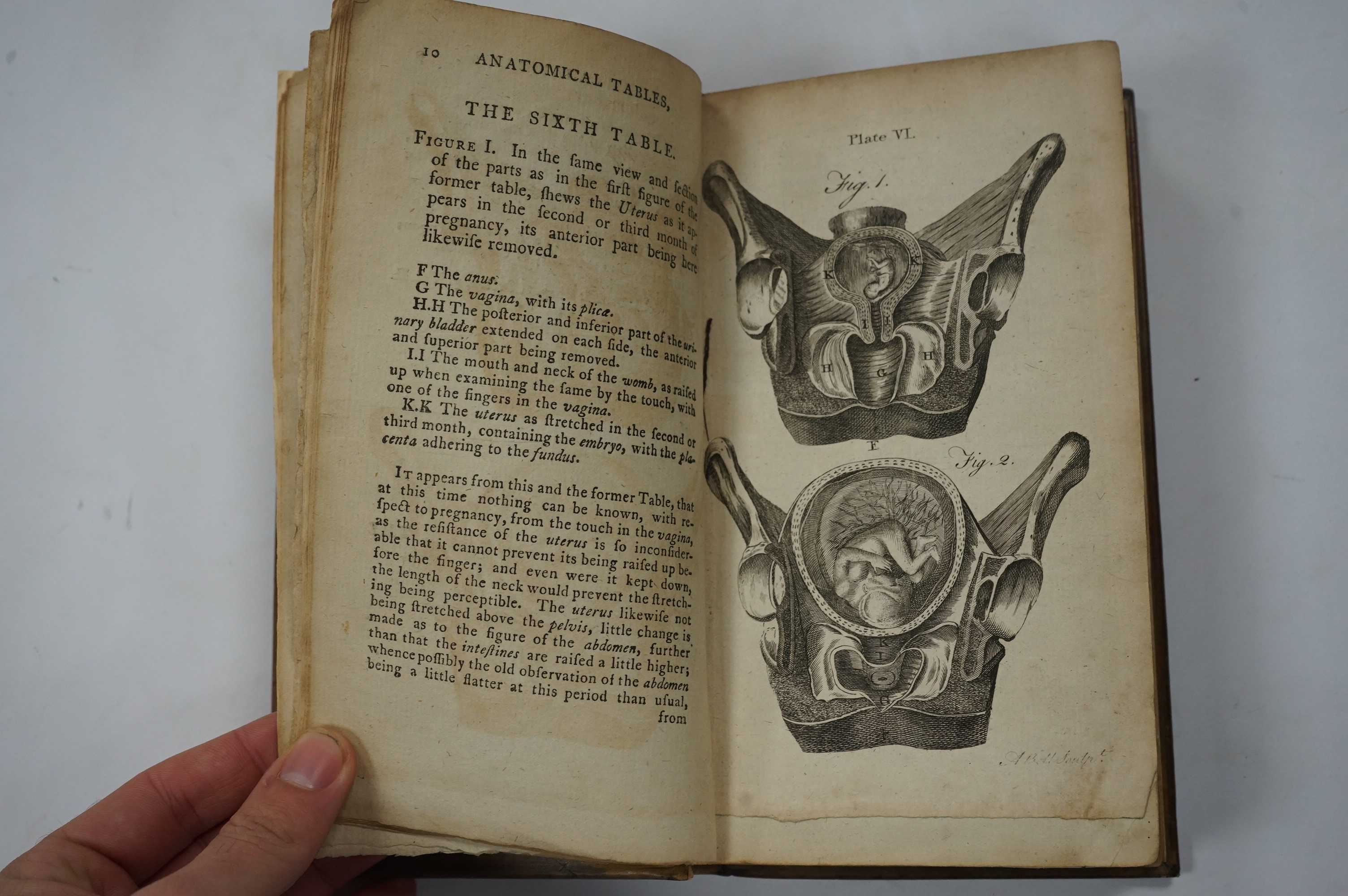 Smellie, William - A Set of Anatomical Tables, with Explanations, and an Abridgement of the Practice of Midwifery ... (new edition). 39 (ex40) engraved plates; sometime rebound 17th cent. style blind decorated panelled c